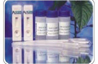 X-连锁凋亡蛋白/性连锁凋亡抑制蛋白抗体 细胞凋亡研究的关键工具